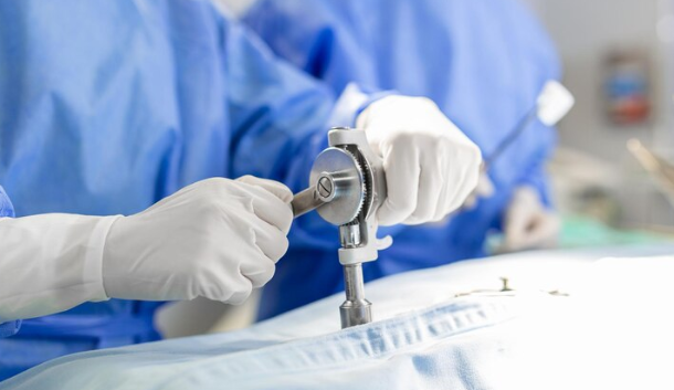 Minimal Invasive Surgery: Revolutionizing Medical Procedures for Improved Patient Wellness